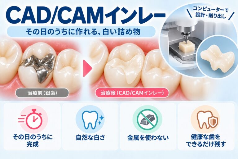 CAD/CAMインレーについて、銀歯から自然な白い詰め物へ交換した治療前後と、コンピューターで設計し専用機器で削り出す仕組みを示した図