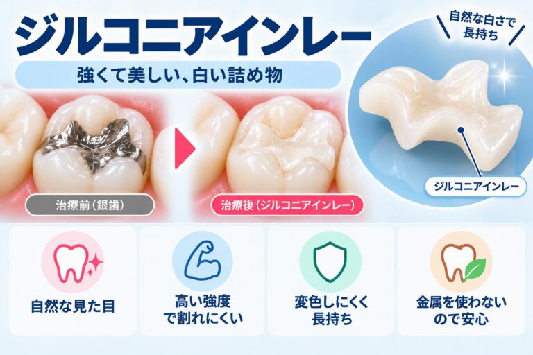 ジルコニアインレーとは｜強度と美しさを兼ね備えた白い詰め物