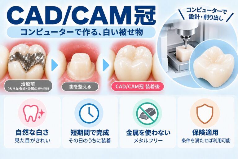 CAD/CAM冠とは｜デジタル技術で作る白い被せ物