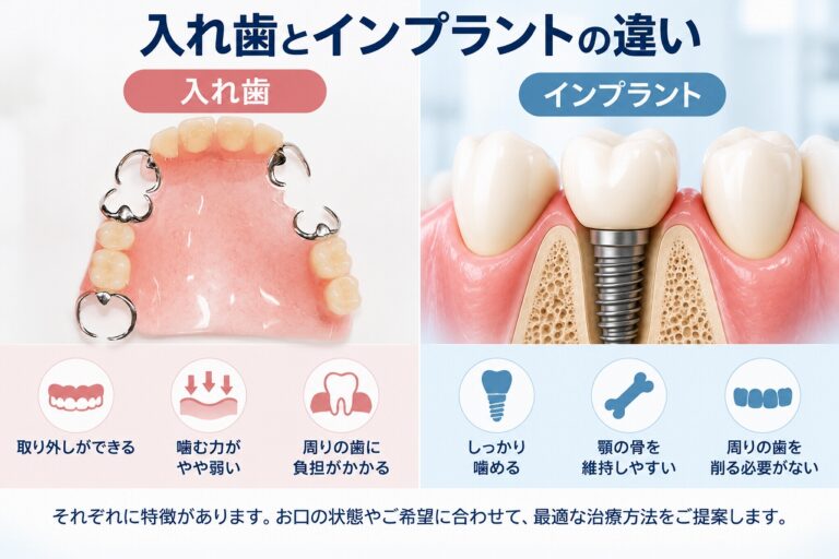 入れ歯とインプラントの違い｜治療方法を比較