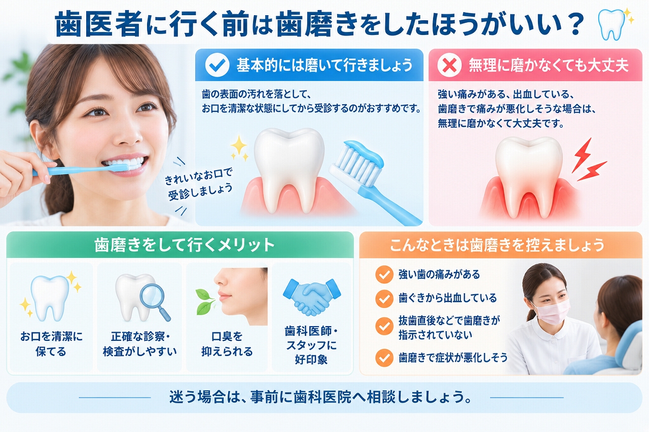 歯医者に行く前に歯磨きをしたほうがよい場合と、無理に磨かなくてもよい場合を示した図