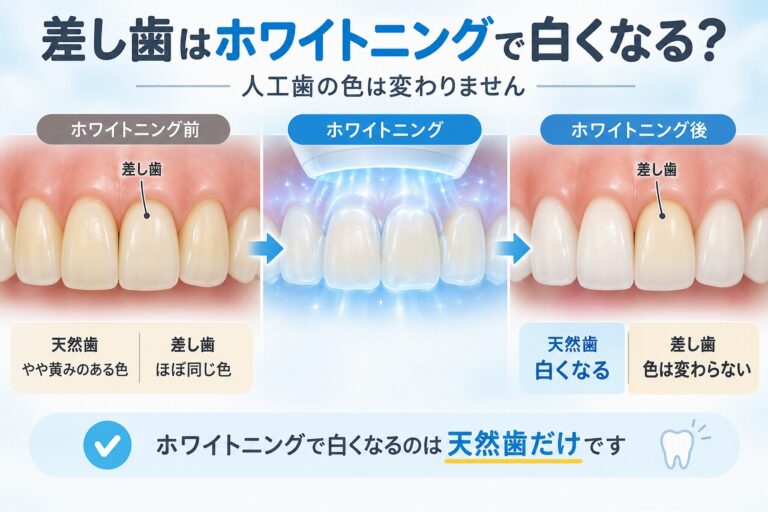 差し歯はホワイトニングで白くなる？｜天然歯との違い