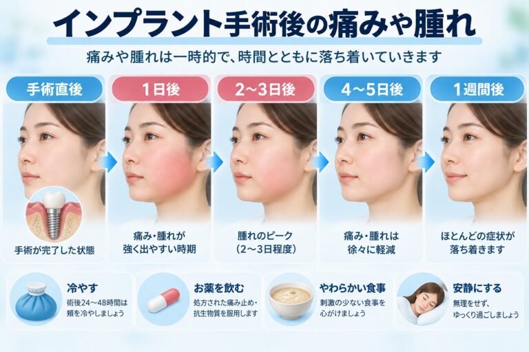 インプラント手術後の痛みや腫れ｜術後の経過と対処法