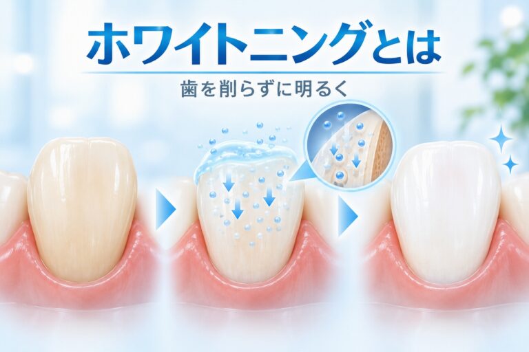 ホワイトニングとは｜歯が白くなる仕組み