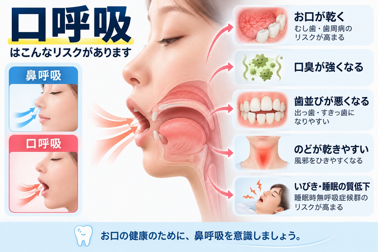 口呼吸による口腔乾燥や口臭、虫歯・歯周病、歯並びへの影響と鼻呼吸との違いを示した図
