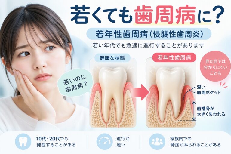 若年性歯周病（侵襲性歯周炎）｜若い年代で進行する歯周病