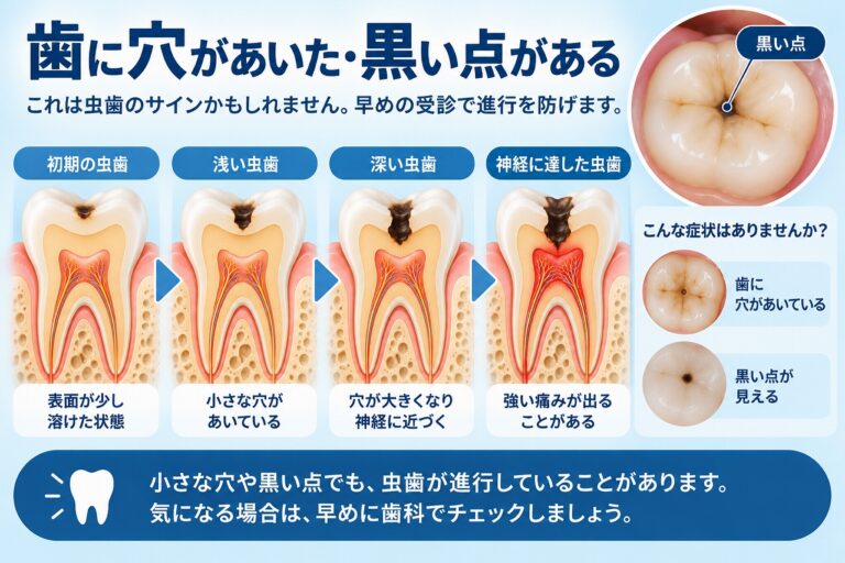 歯に穴があいた・黒い点がある｜虫歯の可能性と進行