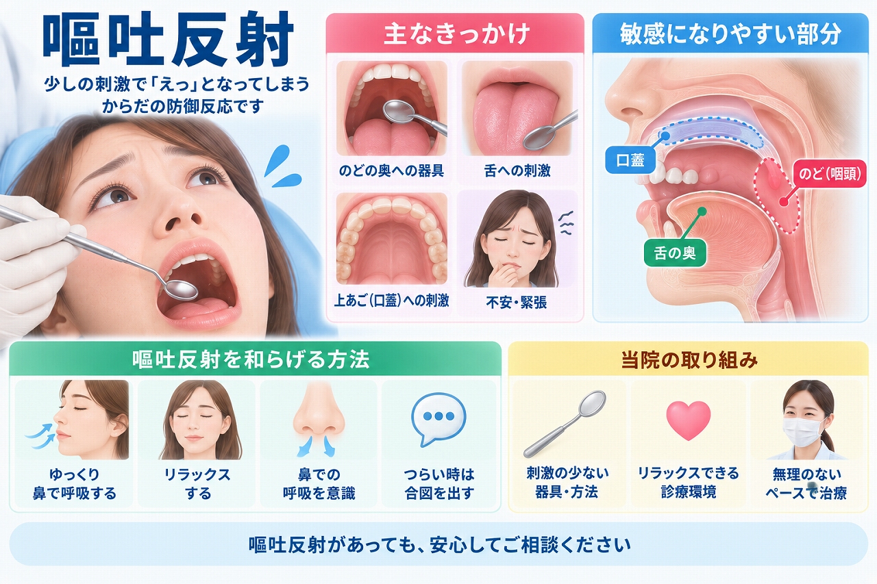 歯科治療中に起こる嘔吐反射の原因となる口蓋・舌の奥・咽頭への刺激と対処法を示した図