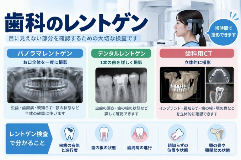 歯科のレントゲン検査｜種類とわかること