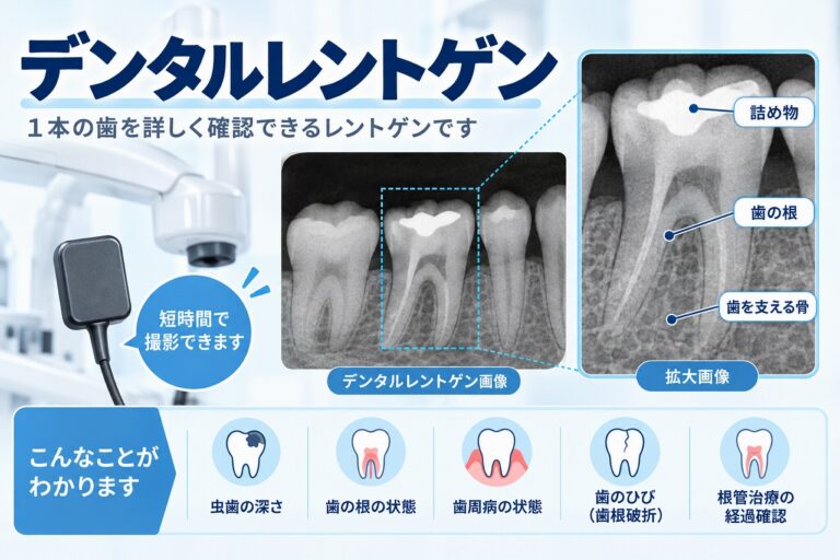 デンタルレントゲンとは？歯の根や虫歯を詳しく確認する検査