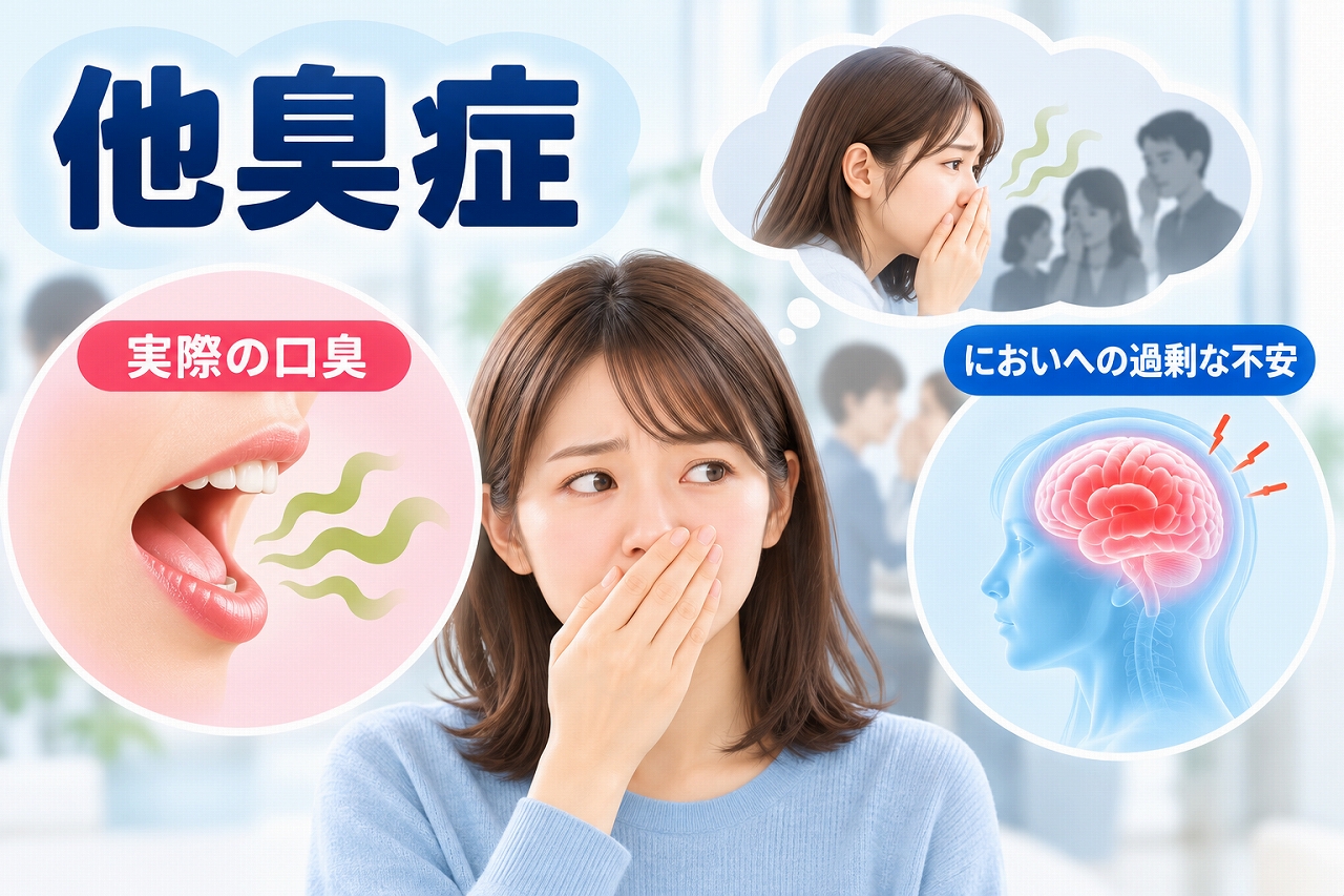 他臭症について、実際には強い口臭がなくても自分の口臭が気になり、周囲の反応を意識してしまう状態と、歯科での確認や相談などの対処法を示した図
