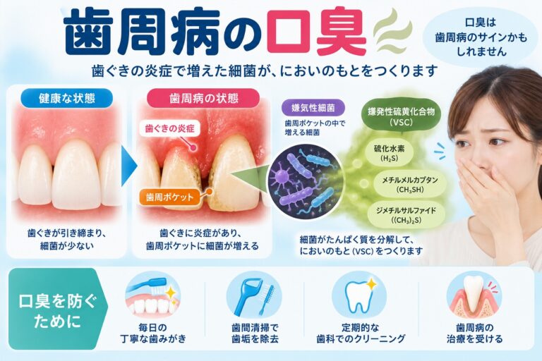 歯周病による口臭｜歯ぐきの炎症と細菌が原因