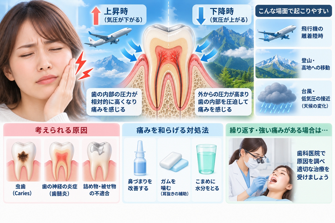 気圧の変化によって歯が痛む仕組みと、飛行機・登山・低気圧などで起こる歯痛の原因を示した図