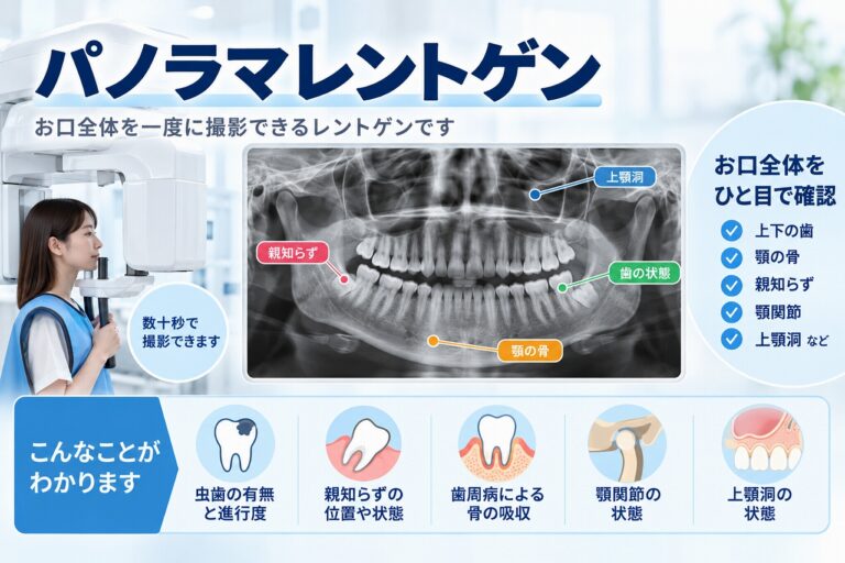 パノラマレントゲンとは？お口全体を一度に確認する歯科検査