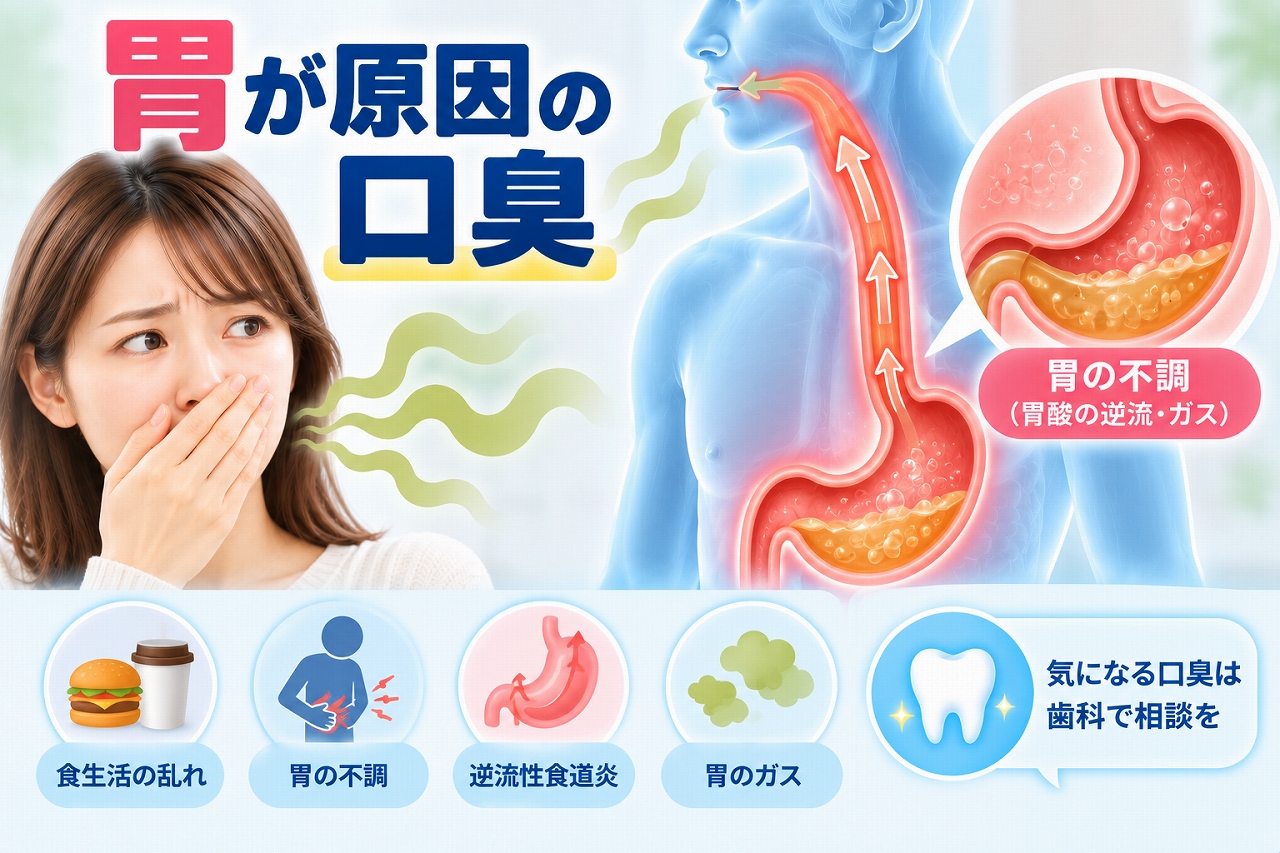 胃が原因と考えられる口臭について、胃酸の逆流や逆流性食道炎など胃の不調と口臭との関係を示した図