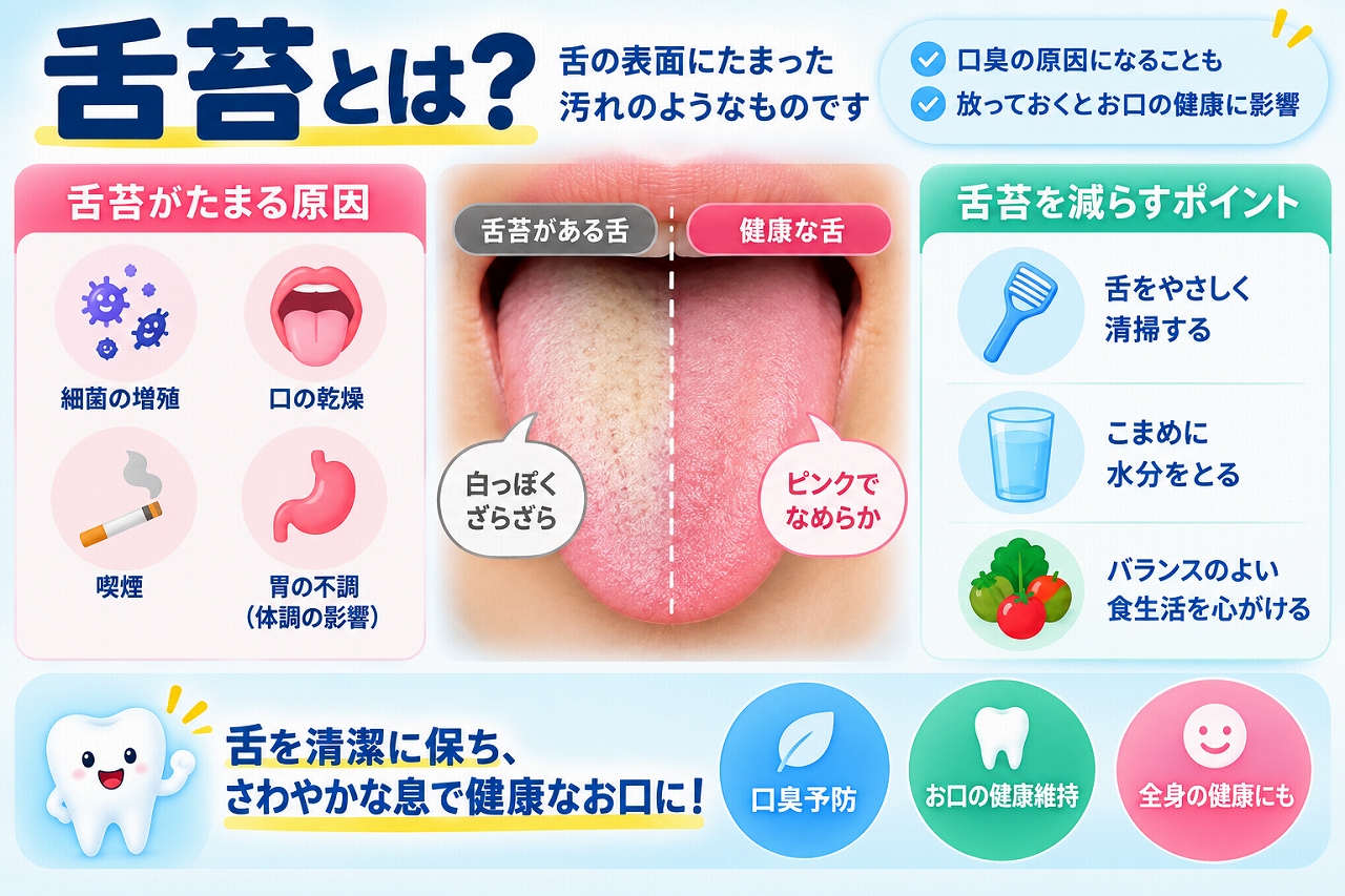 舌苔について、白っぽい舌と健康なピンク色の舌を比較し、舌苔がたまる原因や口臭との関係、舌をやさしく清掃するケア方法を示した図