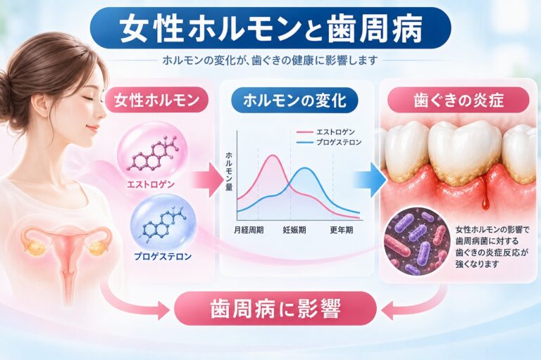 女性ホルモンと歯周病の関係｜ホルモン変化と歯ぐきの炎症