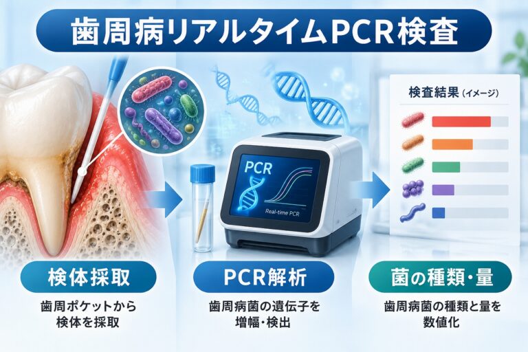 歯周病リアルタイムPCR検査｜歯周病菌の種類と量を調べる検査