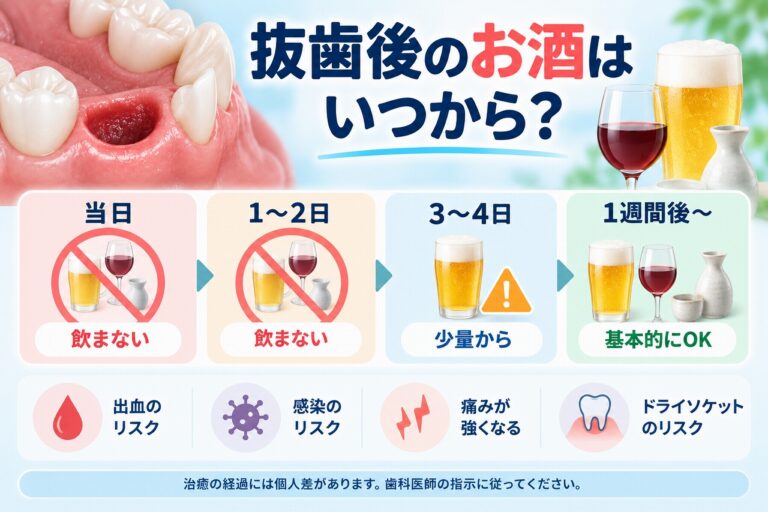 抜歯後のお酒はいつから飲めるのか、飲酒を控える期間と出血・痛み・ドライソケットなどのリスクを示したイラスト