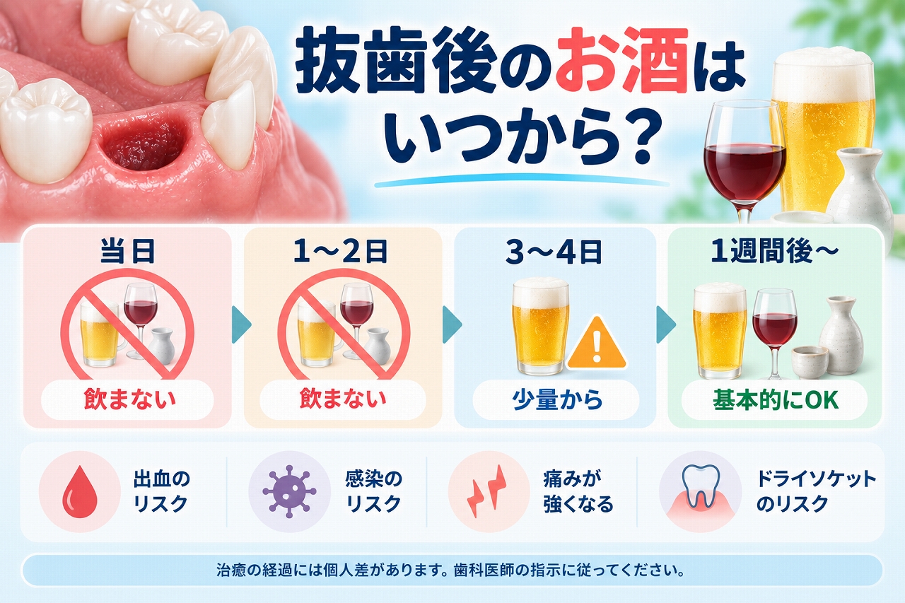 抜歯後のお酒はいつから飲めるのか、飲酒を控える期間と出血・痛み・ドライソケットなどのリスクを示したイラスト