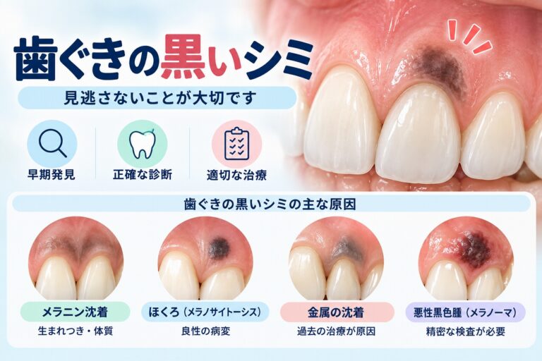 歯ぐきの黒いシミにみられるメラニン沈着・ほくろ・金属沈着・悪性黒色腫などの原因を比較した歯科イラスト