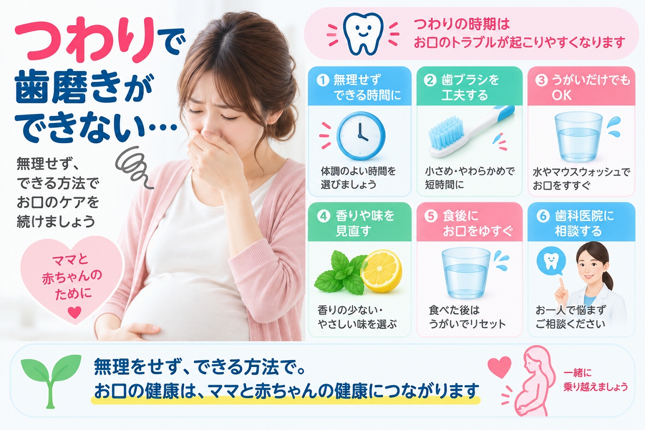 つわりで歯磨きがつらい妊婦さんに向けて、小さめの歯ブラシやうがいなど無理なくできる口腔ケア方法を示したイラスト
