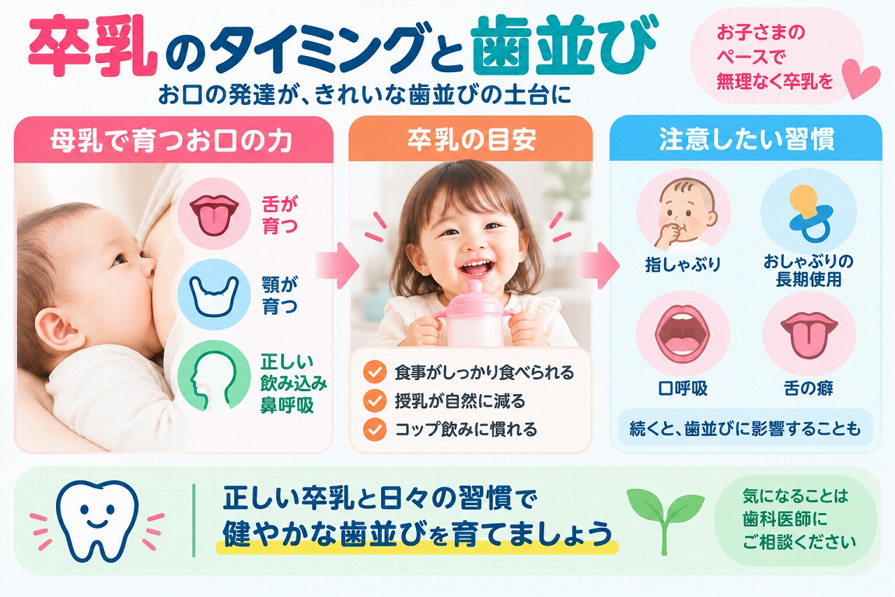 卒乳のタイミングと歯並びの関係について、母乳育児による舌や顎の発達、卒乳の目安、指しゃぶり・おしゃぶり・口呼吸・舌癖など注意したい習慣を示したイラスト