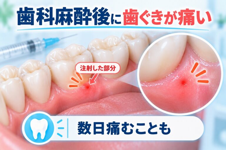 歯科麻酔後に歯ぐきが痛い｜注射した部分が数日痛む原因