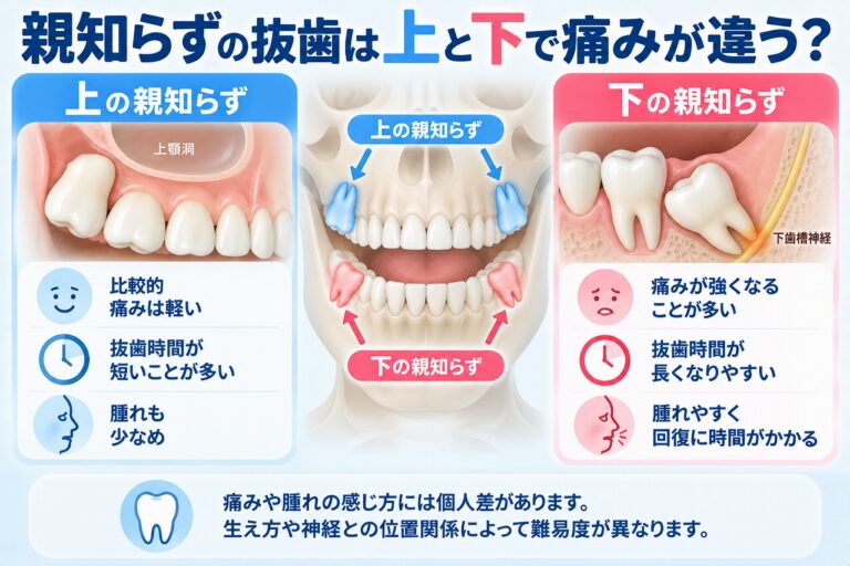 親知らずの抜歯は上と下で痛みが違う？｜腫れ・抜歯時間・難易度を比較