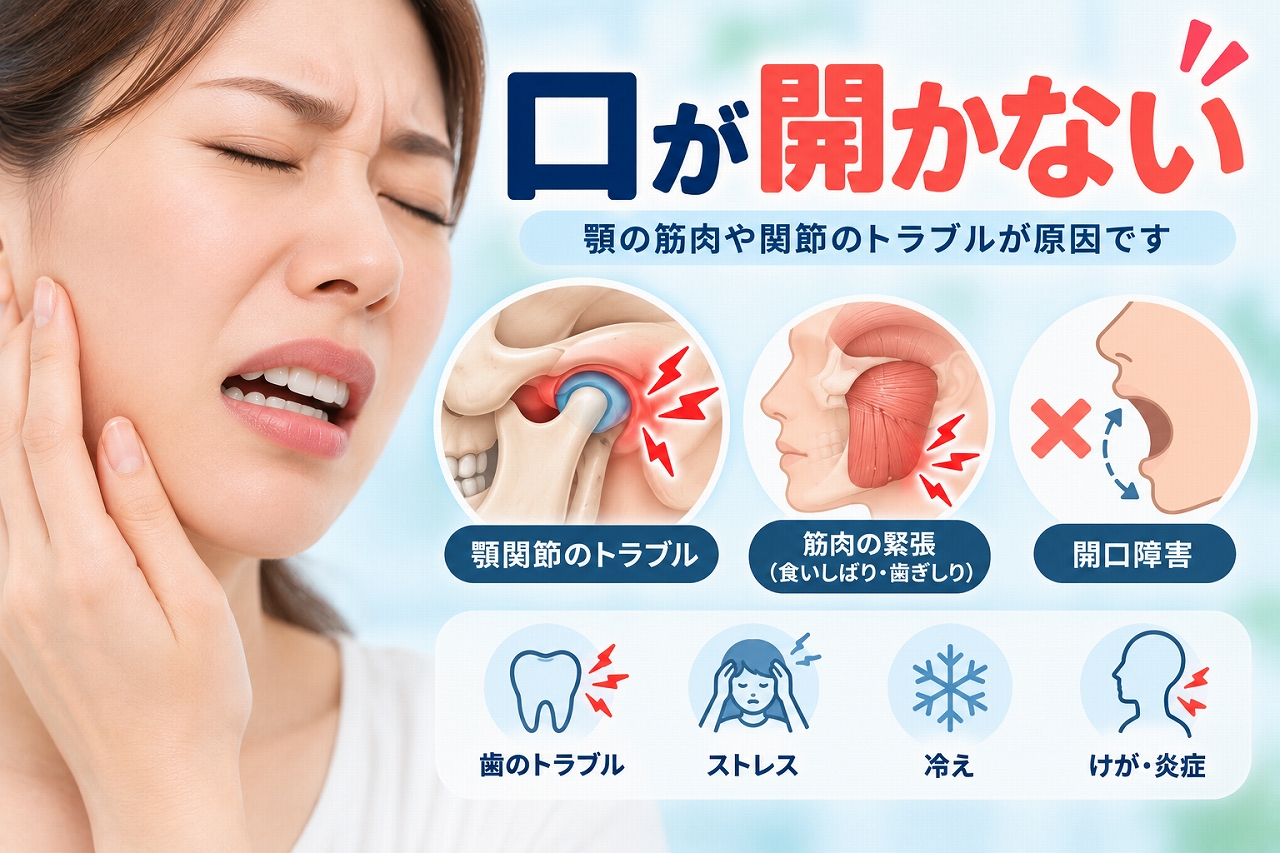 口が開かない開口障害と、顎関節のトラブルや食いしばり・歯ぎしりによる筋肉の緊張を示したイラスト