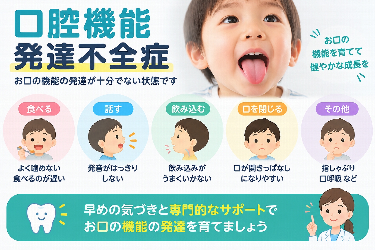 口腔機能発達不全症でみられる、噛みにくい・発音しにくい・飲み込みにくい・口が開きやすい・口呼吸などの特徴を示したイラスト