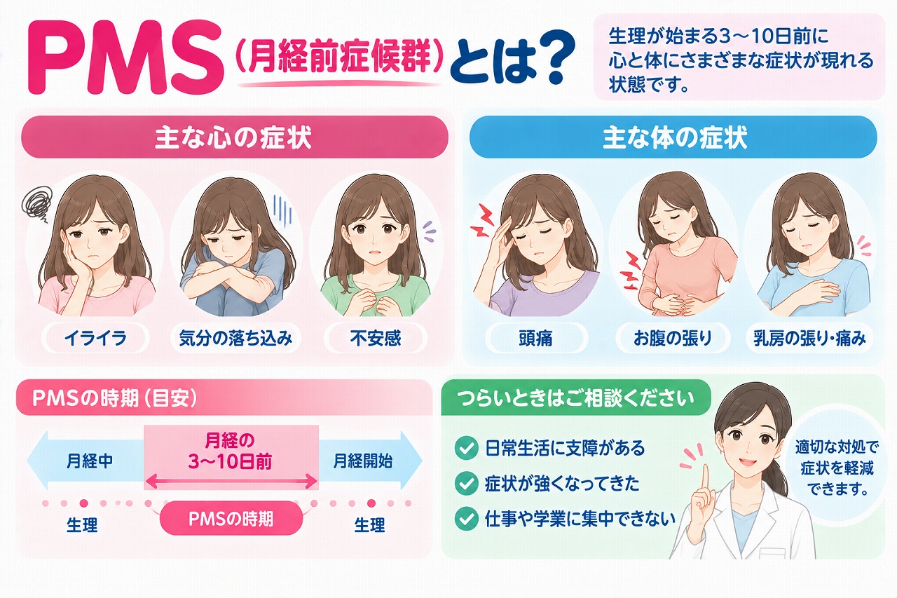 PMS（月経前症候群）の症状や起こる時期を解説したインフォグラフィック。生理前に現れるイライラ、気分の落ち込み、不安感などの心の症状と、頭痛、お腹の張り、乳房の張り・痛みなどの体の症状を紹介