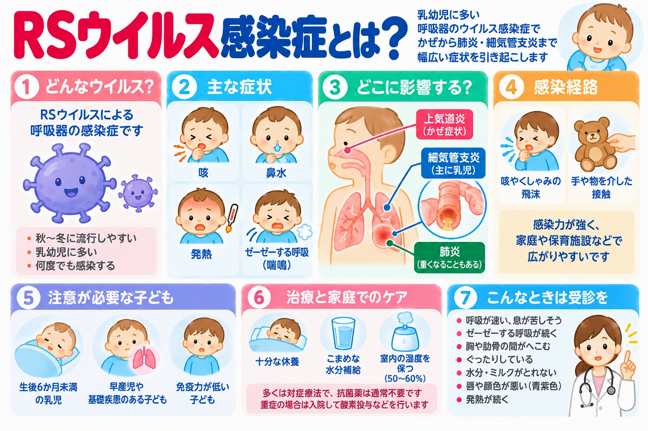 RSウイルス感染症の原因や症状、感染経路、治療法を解説した医療インフォグラフィック。乳幼児に多い咳、鼻水、発熱、ゼーゼーする呼吸などの症状と、細気管支炎や肺炎を起こす仕組みを紹介。飛沫感染や接触感染、重症化しやすい乳児の特徴、家庭でのケア、呼吸困難や哺乳不良などの受診の目安を図解。