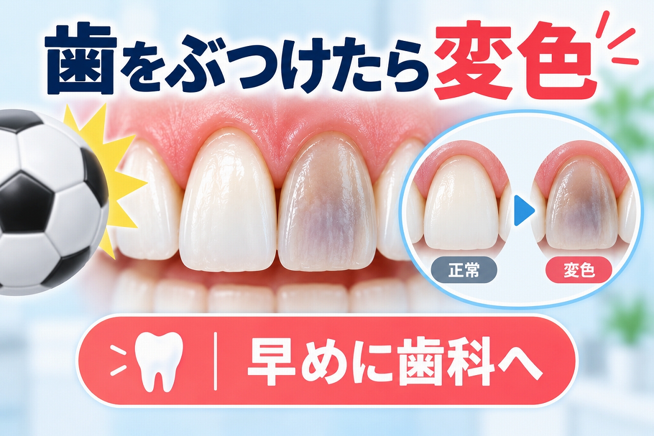 歯をぶつけた後に前歯が灰色や紫色に変色した状態と正常な歯を比較したイラスト
