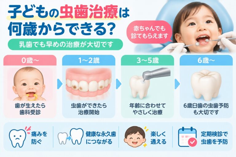 子どもの虫歯治療を0歳から6歳以降まで年齢別に示し、乳歯の虫歯も早めの歯科受診と治療が大切なことを説明したイラスト