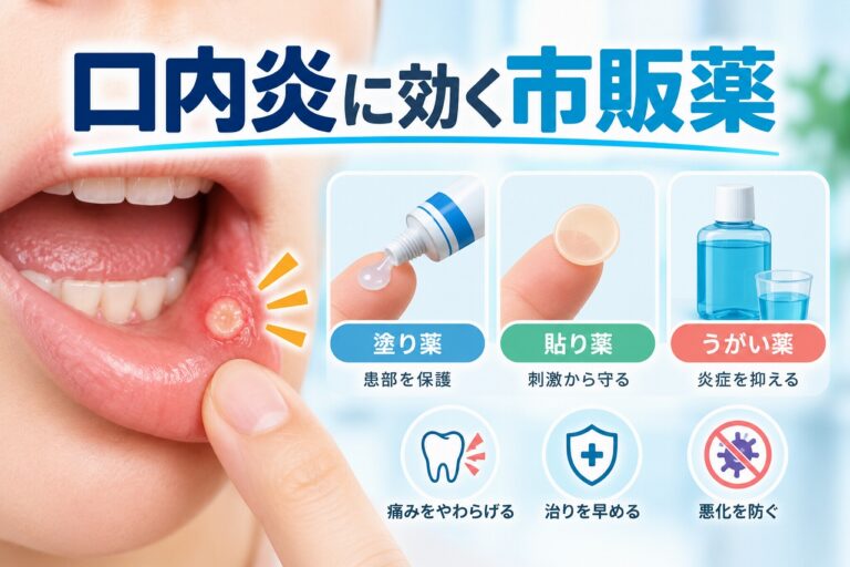 口内炎に使用する市販薬として、塗り薬・貼り薬・うがい薬の3種類とそれぞれの特徴を示したイラスト