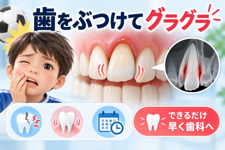 歯をぶつけてグラグラする｜歯の外傷・動揺は早めに歯科へ