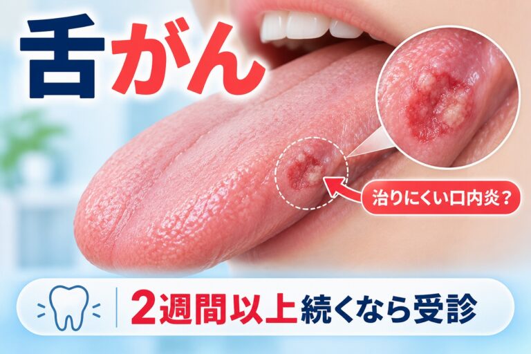 舌がん｜治りにくい口内炎や舌の異変に注意