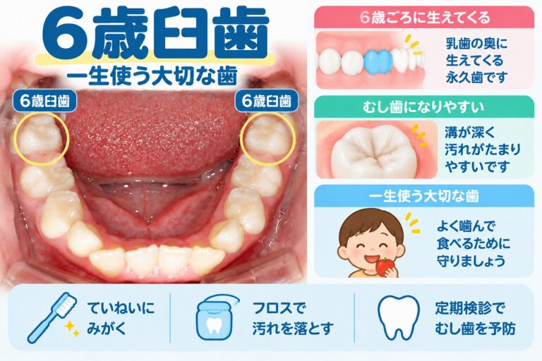 乳歯の一番奥に生える6歳臼歯の位置と、溝が深く虫歯になりやすいため丁寧な歯磨きが大切なことを示した歯科イラスト