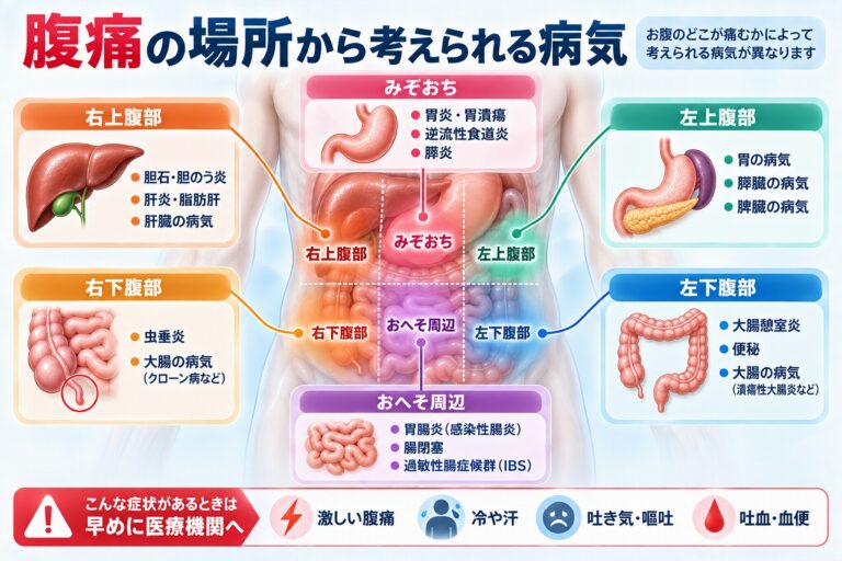 腹痛の場所を右上腹部・みぞおち・左上腹部・右下腹部・おへそ周辺・左下腹部に分け、胆石・胃炎・膵炎・虫垂炎・腸閉塞・大腸憩室炎など考えられる病気を示した図
