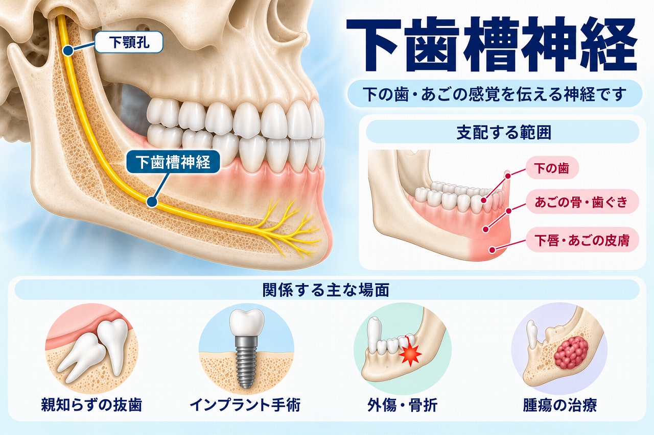 下顎骨の中を走る下歯槽神経の位置と、下の歯・歯ぐき・下唇・あごの感覚との関係を示した歯科イラスト