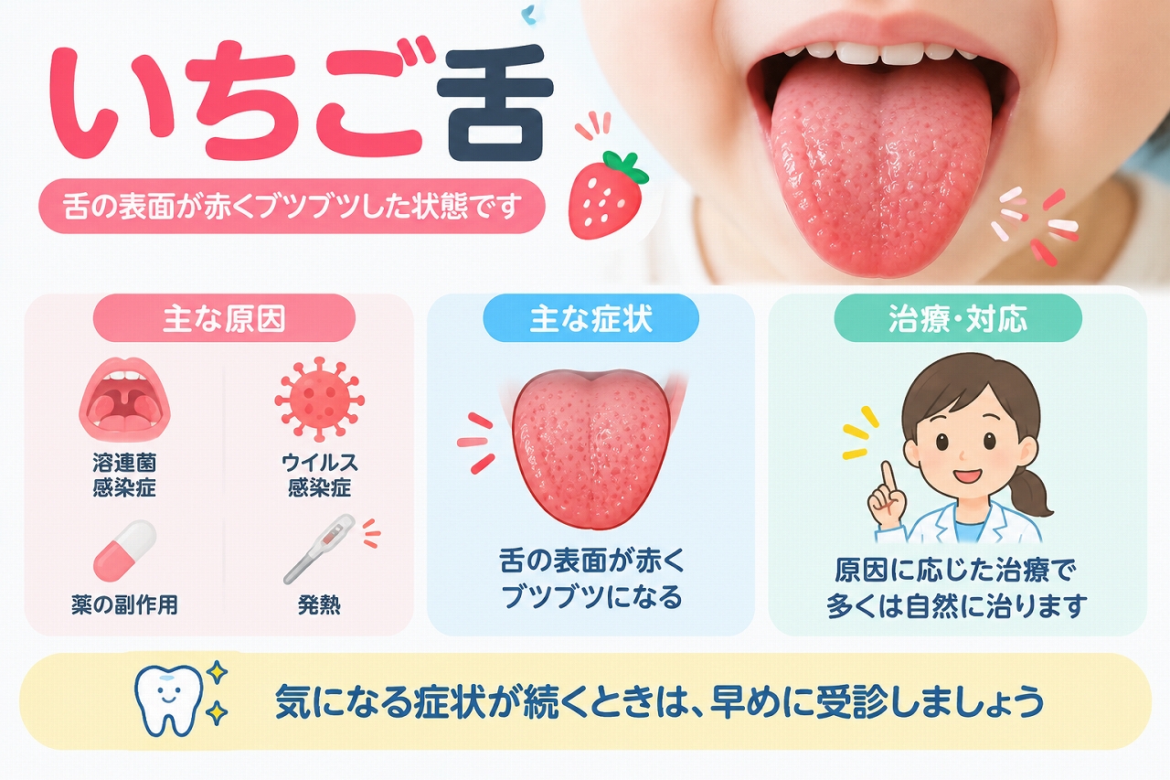 いちご舌で舌の表面が赤くなり、舌乳頭が目立ってブツブツしている状態と主な原因を示した医療イラスト