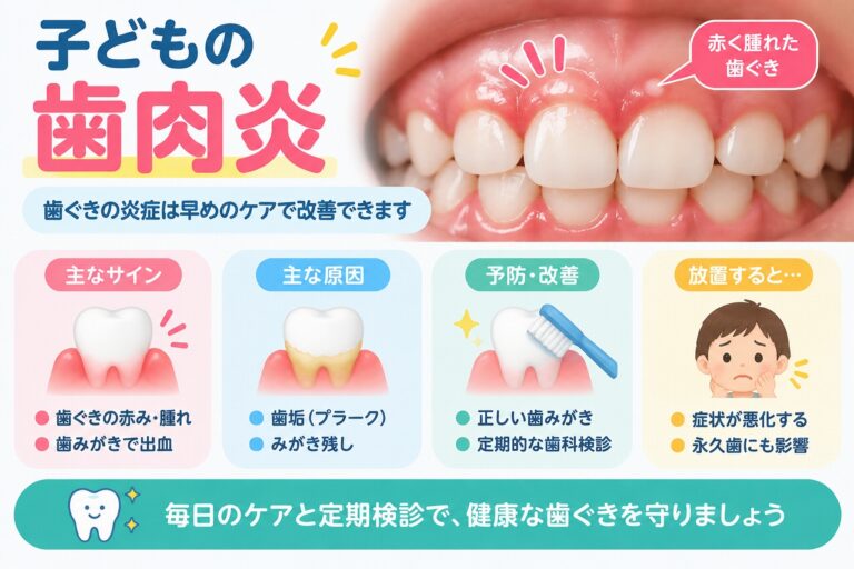 子どもの歯肉炎による歯ぐきの赤み・腫れ・歯磨き時の出血と、歯垢や磨き残しなどの原因、予防方法を示した歯科イラスト