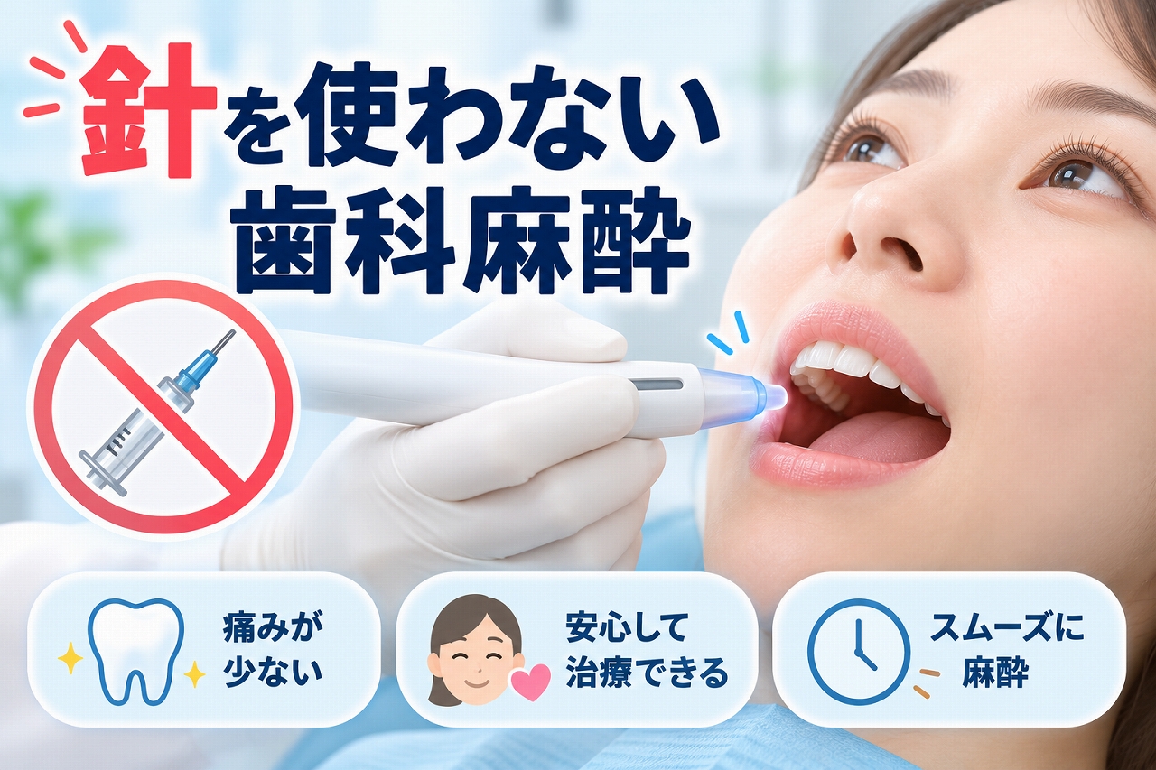 注射針を使わない歯科麻酔を使用し、痛みに配慮して麻酔を行う様子を示したイラスト