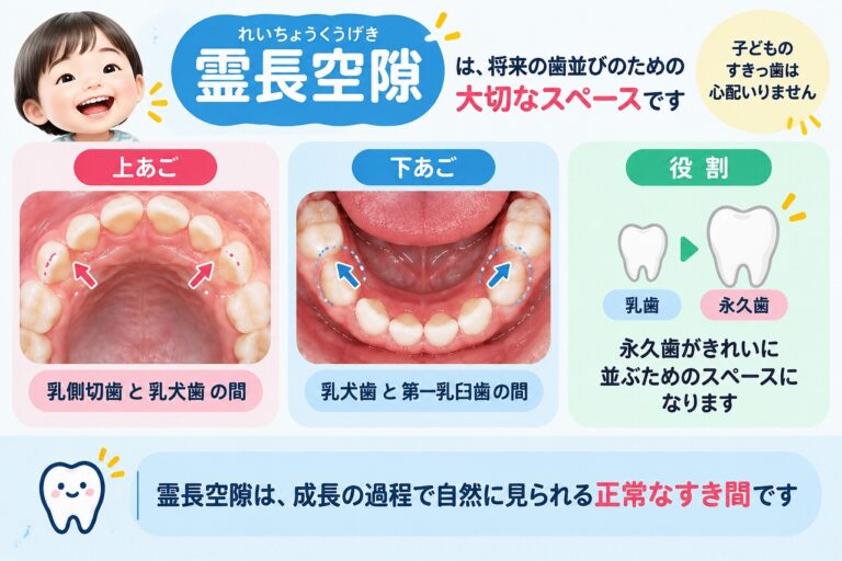 霊長空隙とは？｜乳歯のすき間が永久歯の歯並びに大切な理由