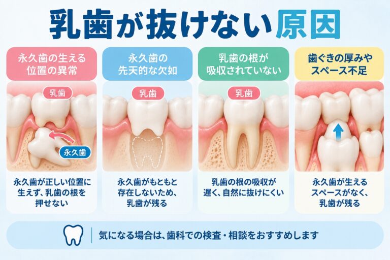 乳歯が抜けない原因｜永久歯が生えても乳歯が残るのはなぜ？