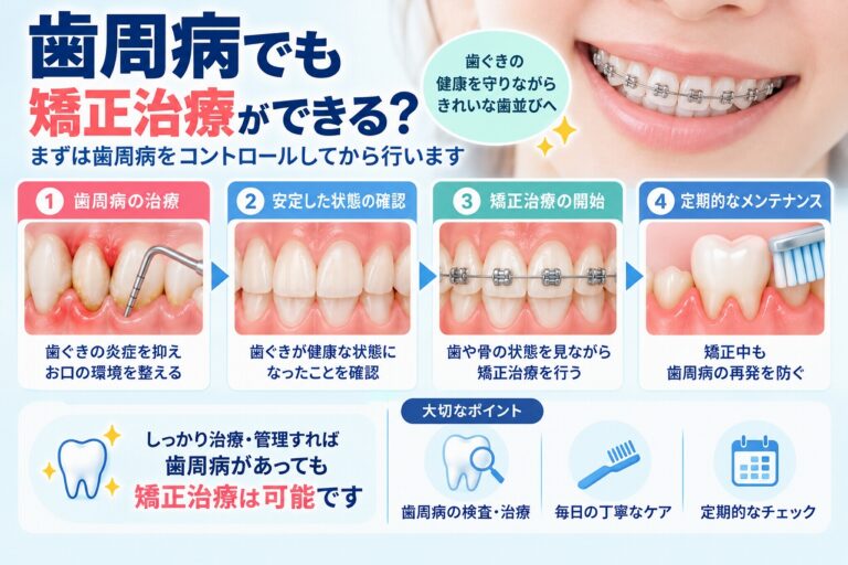 歯周病がある場合の矯正治療について、歯周病の治療から状態の安定確認、矯正治療、定期的なメンテナンスまでの流れを示した歯科イラスト