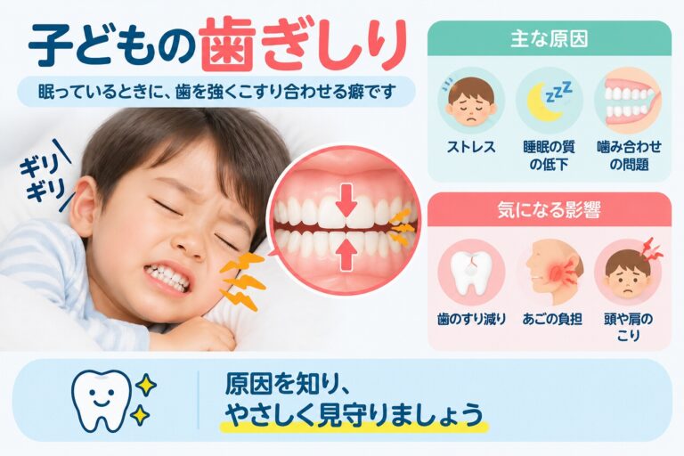 子どもの歯ぎしりについて、睡眠中に歯を強くこすり合わせる様子と、歯のすり減りやあごへの負担などを示した歯科イラスト