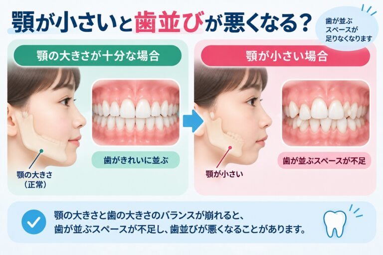 顎が小さいと歯並びが悪くなる？歯が並ぶスペースとの関係