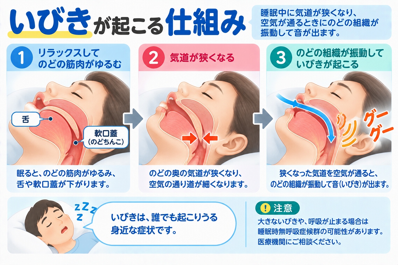 いびきが起こる仕組みを解説したインフォグラフィック。睡眠中にのどの筋肉がゆるみ、舌や軟口蓋などによって気道が狭くなり、空気が通る際にのどの組織が振動していびきの音が生じる流れを紹介
